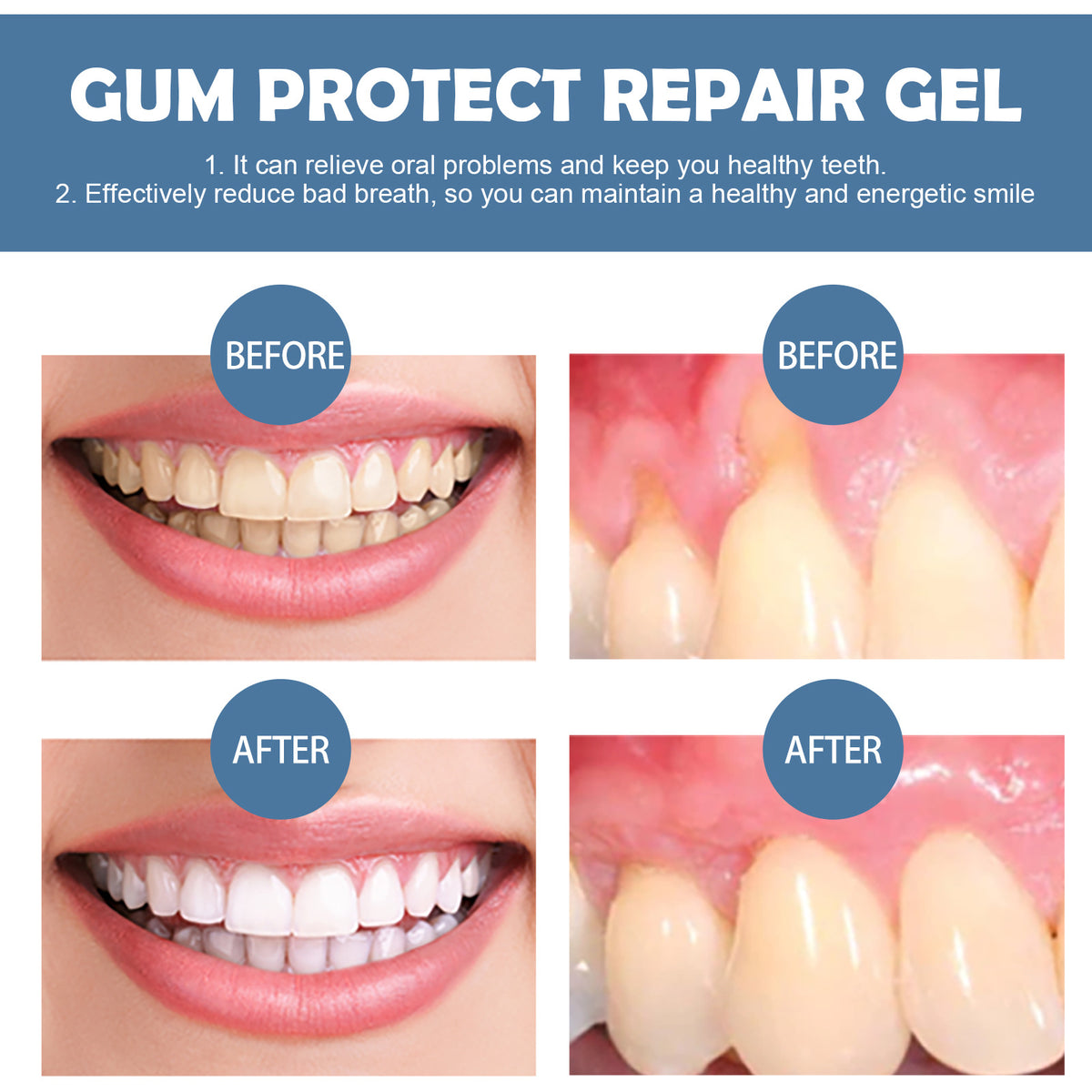 KeenrobeⓁ 3/6/9Pcs 🦷Protect your teeth refresh your mouth✨